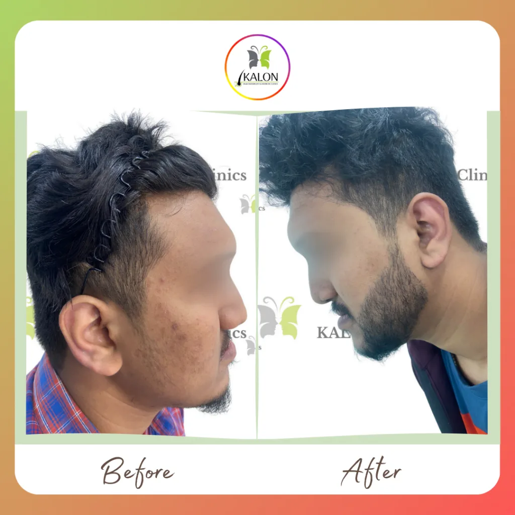 success story