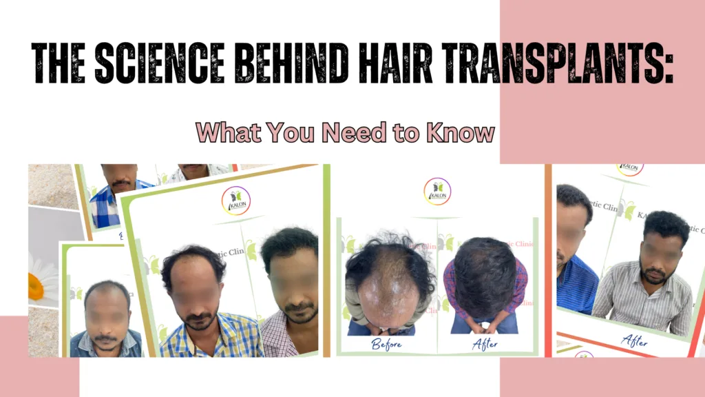 best hair transplant clinic in visakhapatnam