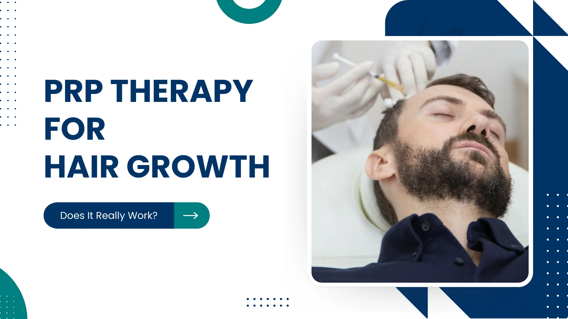 PRP Therapy for Hair Growth: Does It Really Work?