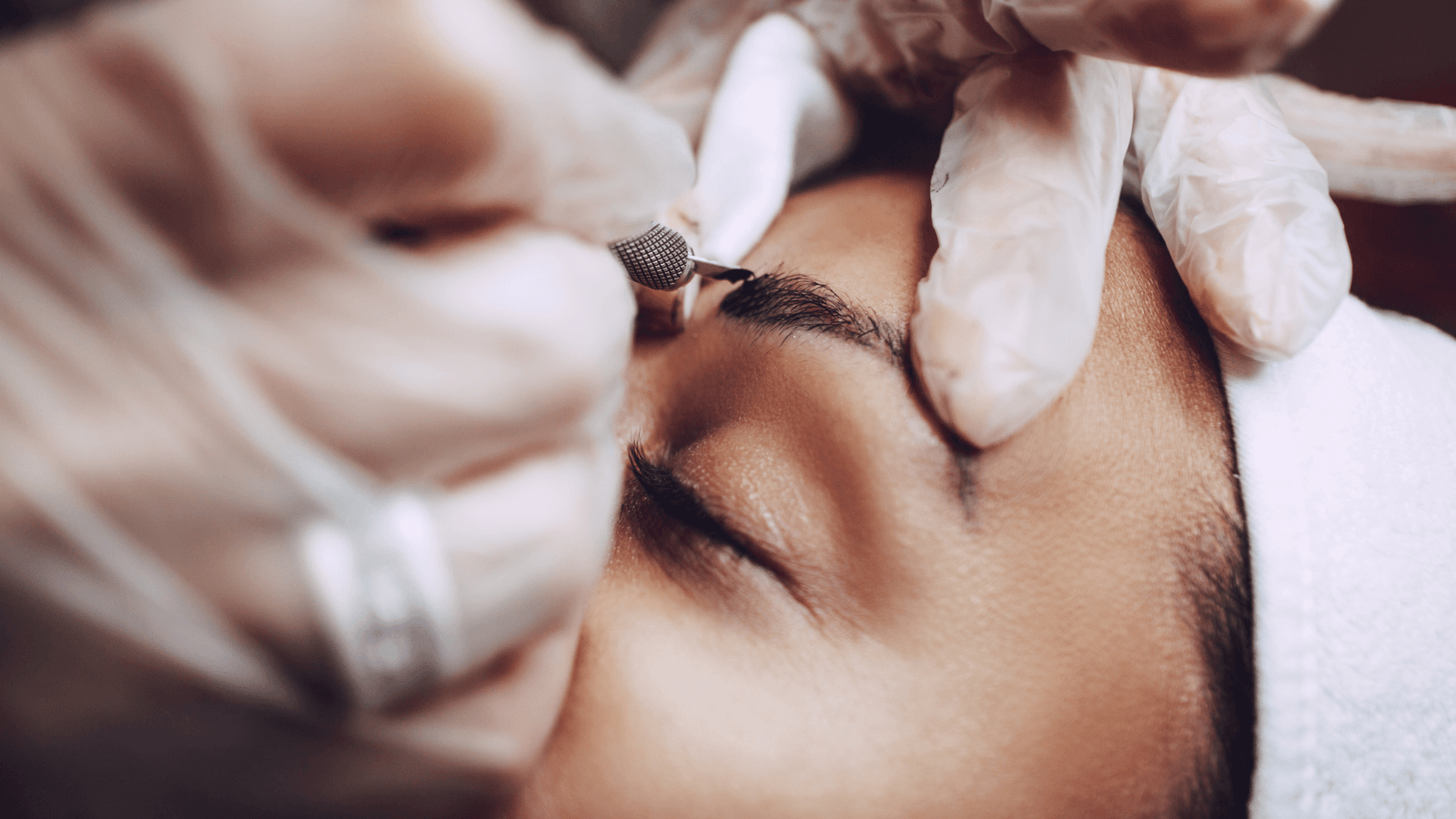 Eyebrow Transplant