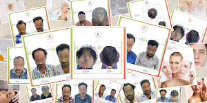 Kalon Hair Transplant & Cosmetic Clinics place picture